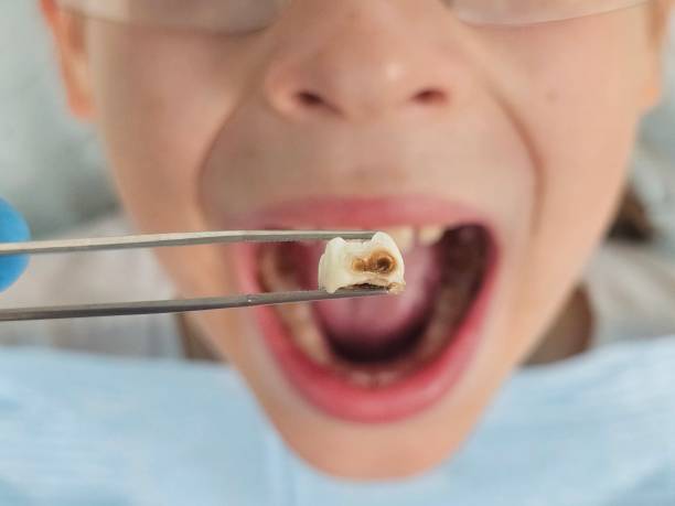 Best Emergency TMJ Treatment in Mingo Junction, OH